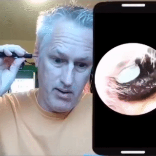 kaufsy | Kabelloses Endoskop HD Ohrpickerset