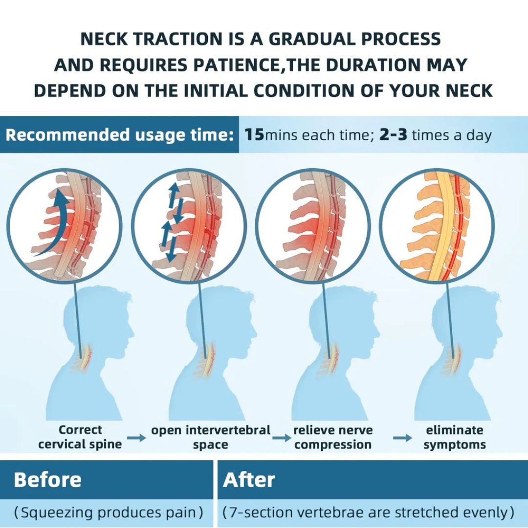 kaufsy | Nackenstrecker zur Schmerzlinderung - Verstellbares zervikales Traktionsgerät Ideal bei Nackenspannung und Unbehagen