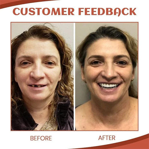 kaufsy | SiliconeAdjust - Zahnprothesen-Set – Verabschieden Sie sich von Zahnprothesenbeschwerden!