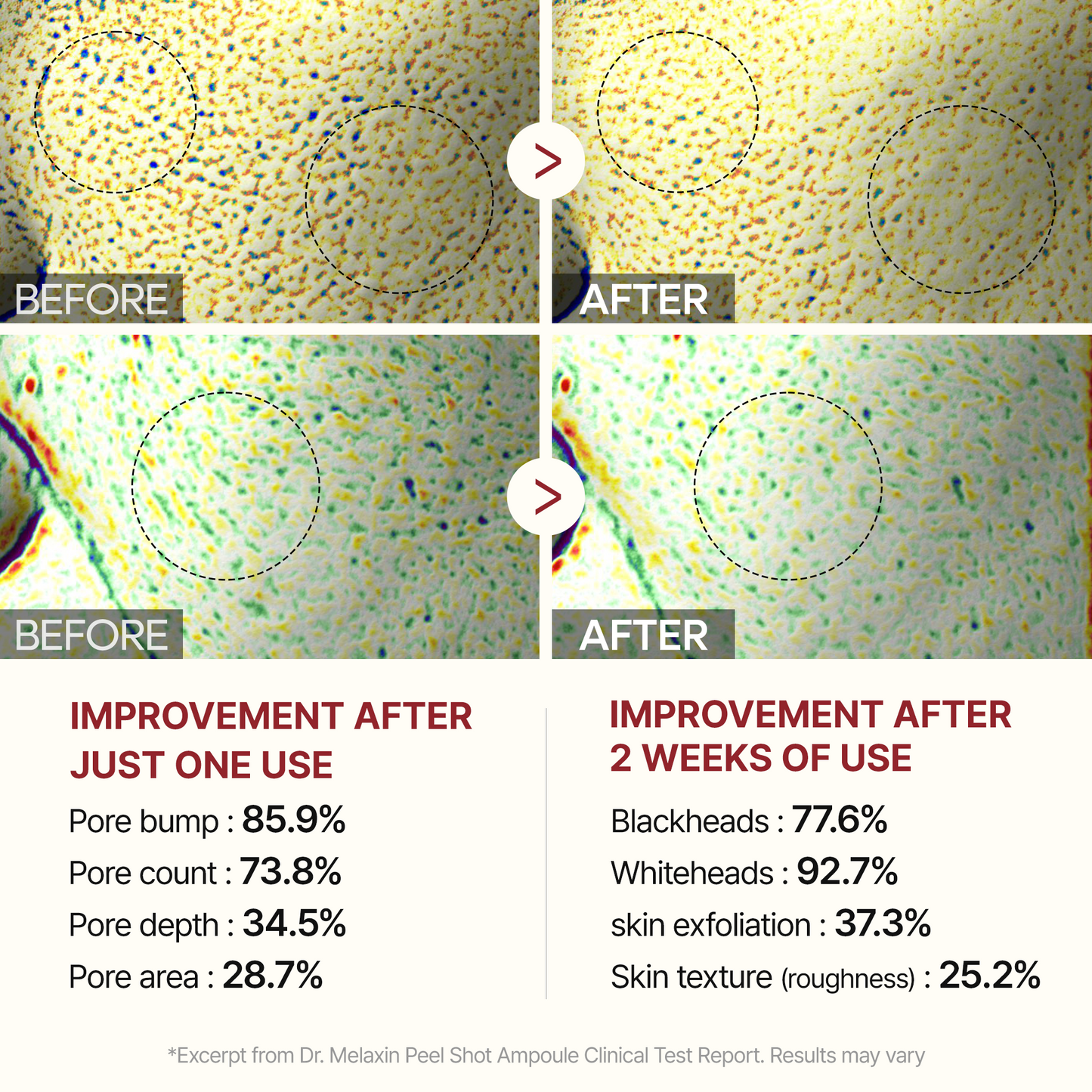 Aufhellendes Reisserum für Gesicht, Tagespflege mit Reisextrakt & Hyaluron