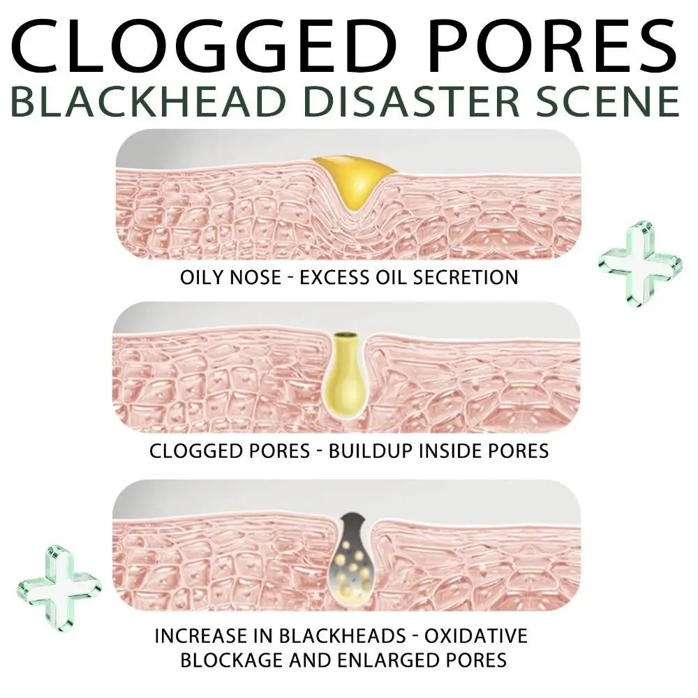 kaufsy | Schwarzer Tee Gesicht Peel-off Maske