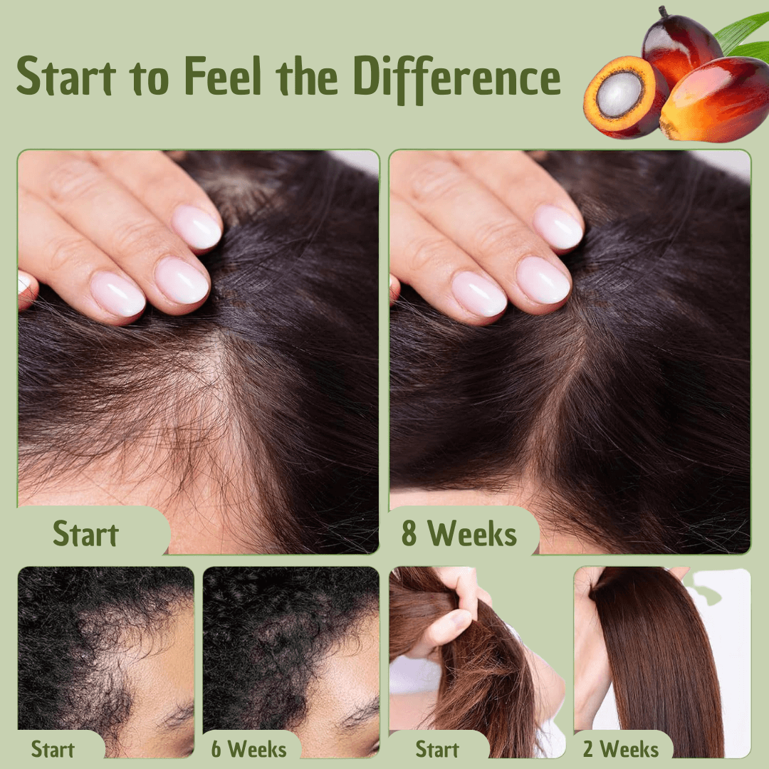 Batana Hair Oil – Pflegeöl für volleres, kräftiger aussehendes Haar mit Omega-Fettsäuren & Vitamin E