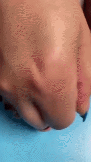 kaufsy | Flexibler orthopädischer Hallux valgus Korrektor